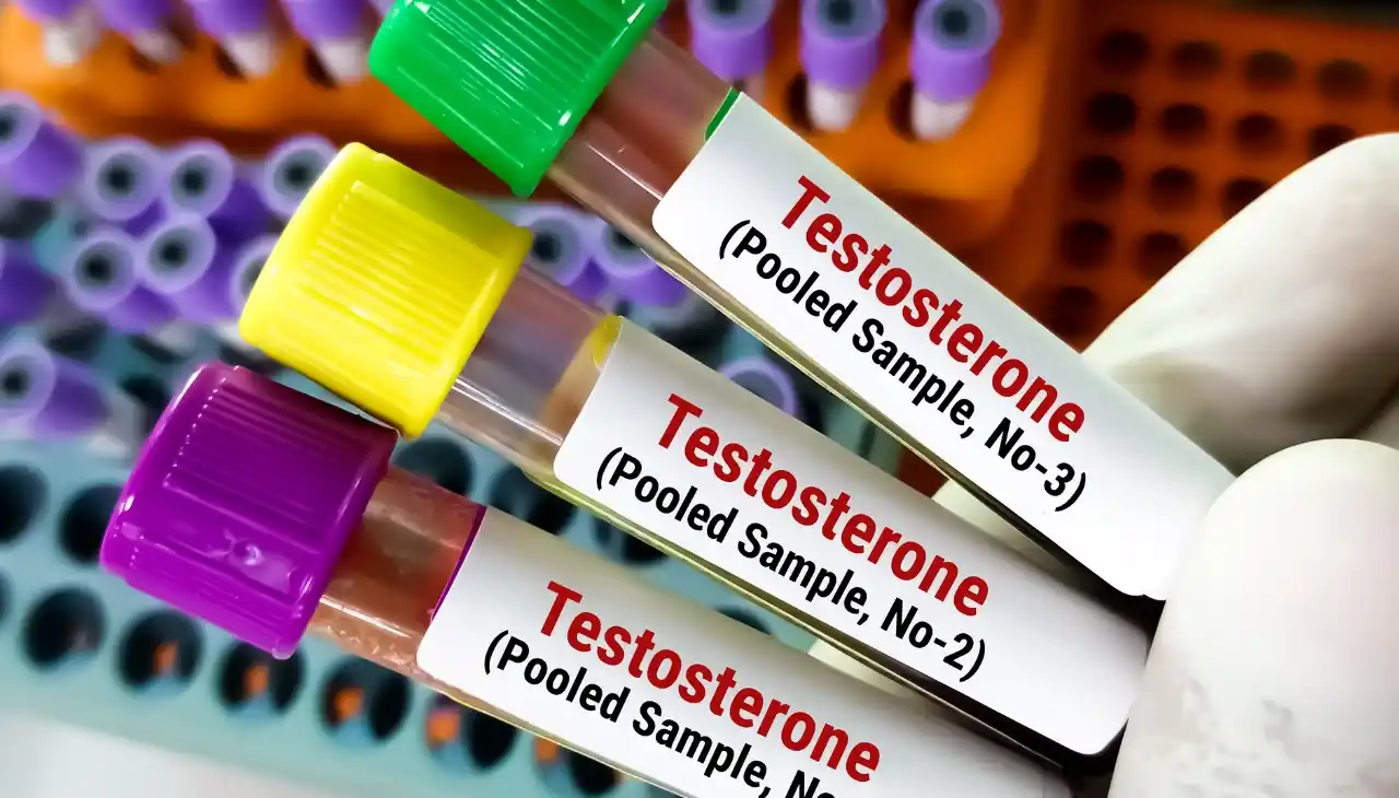 Testosterone test