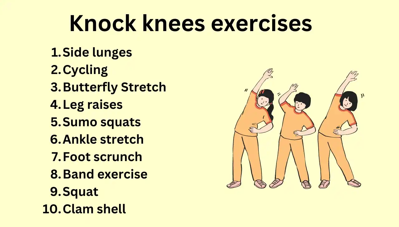 Knock knees exercises