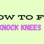 How to Fix Knock Knees